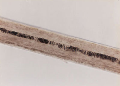 human hair under microscope medulla